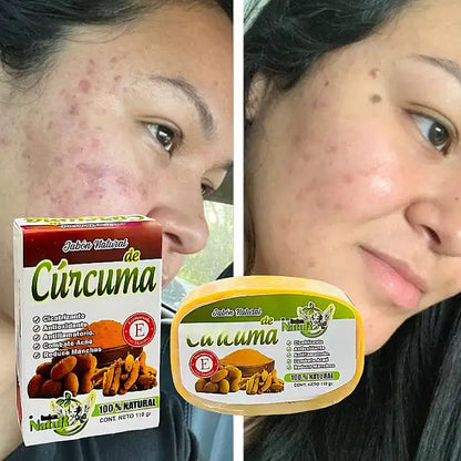 PACK ANTIEDAD (MASAJEADOR FACIAL LED + 5 MASCARILLAS + JABON DE CURCUMA)